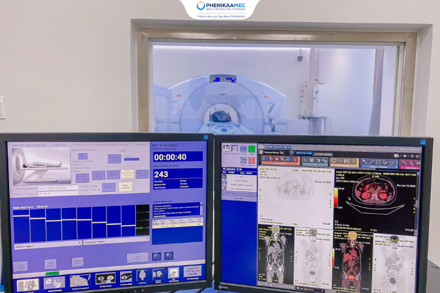 &rlm;Lưu &yacute; khi chụp PET/CT: Những điều người bệnh cần biết trước, trong v&agrave; sau khi chụp&rlm; - Ảnh 3.