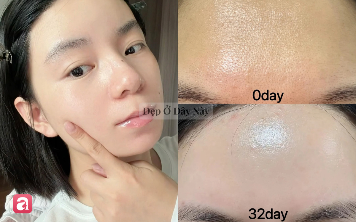 V&igrave; sao nhiều người chuyển từ tẩy da chết dạng hạt sang loại "lỏng như nước"? - Ảnh 1.
