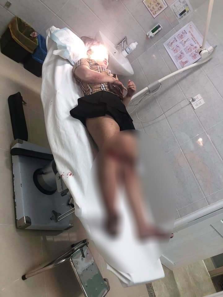 Một cô gái nhập viện sau vụ tai nạn