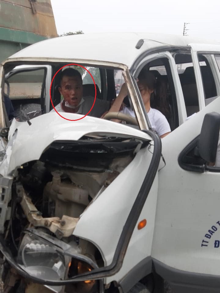 Biểu hiện tr&ecirc;n khu&ocirc;n mặt của thầy gi&aacute;o dạy l&aacute;i xe khiến nhiều người ch&uacute; &yacute;