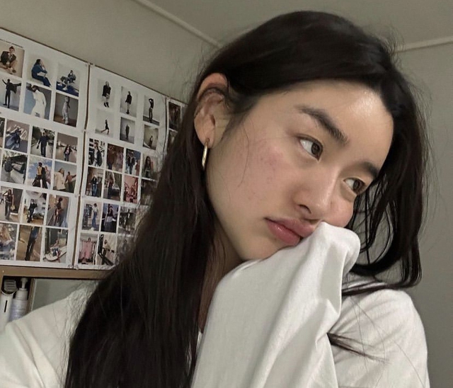 4 thay đổi trên khuôn mặt là CẢNH BÁO SỚM của bệnh ung thư, có người soi gương ngày mấy lần mà không nhận ra- Ảnh 2. 4 thay đổi trên khuôn mặt là CẢNH BÁO SỚM của bệnh ung thư, có người soi gương ngày mấy lần mà không nhận ra- Ảnh 2.