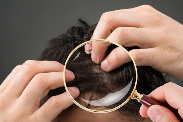 Không phải cứ có tóc bạc là lão hóa: Có 2 loại tóc trắng này trên đầu thì bạn cần đi khám sớm xem có mắc bệnh nào không- Ảnh 1.