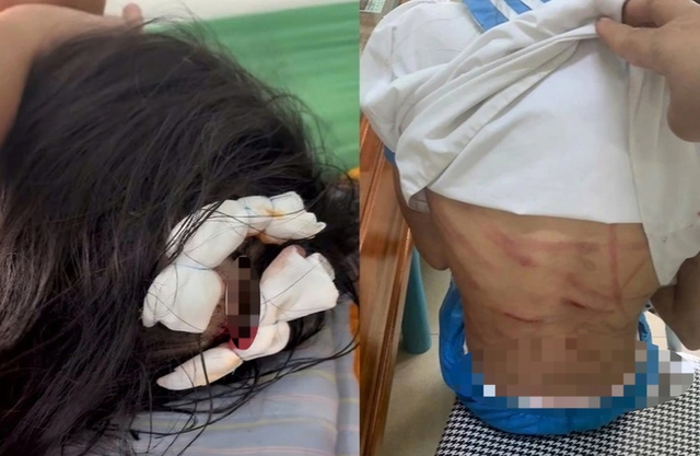 Vụ cô bé lớp 5 bị cha dượng bạo hành: Lời của 1 bà mẹ đơn thân nuôi 2 con khôn lớn, phụ nữ hãy tìm hạnh phúc cho mình, nhưng đừng bằng mọi giá- Ảnh 1. Vụ cô bé lớp 5 bị cha dượng bạo hành: Lời của 1 bà mẹ đơn thân nuôi 2 con khôn lớn, phụ nữ hãy tìm hạnh phúc cho mình, nhưng đừng bằng mọi giá- Ảnh 1.