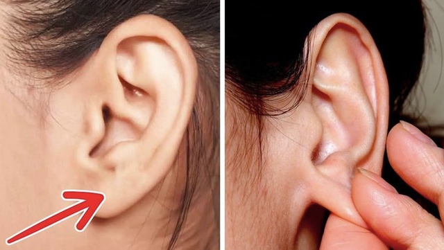 Tai - bản đồ thu nhỏ của cơ thể: Thực hiện hành động này 5 phút/ngày, hơn cả tẩm bổ nhân sâm!- Ảnh 2.