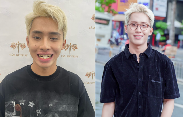 Phương pháp chữa bệnh nhiều người tưởng “chỉ để làm đẹp”- Ảnh 1. Phương pháp chữa bệnh nhiều người tưởng “chỉ để làm đẹp”- Ảnh 1.