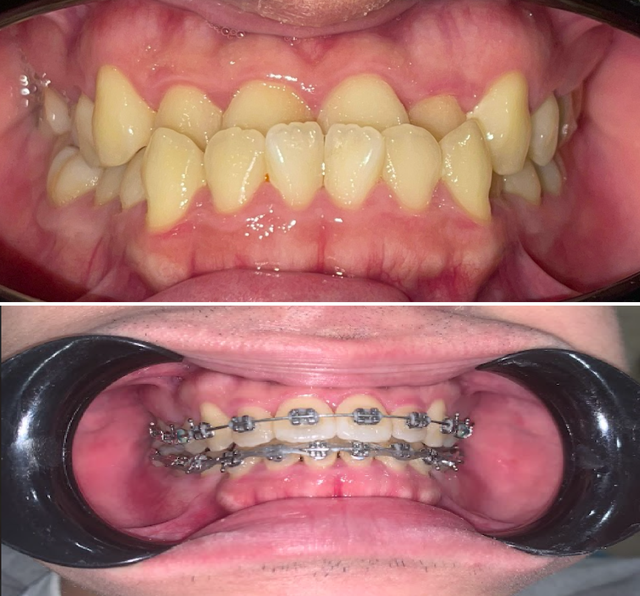 Phương pháp chữa bệnh nhiều người tưởng “chỉ để làm đẹp”- Ảnh 2. Phương pháp chữa bệnh nhiều người tưởng “chỉ để làm đẹp”- Ảnh 2.