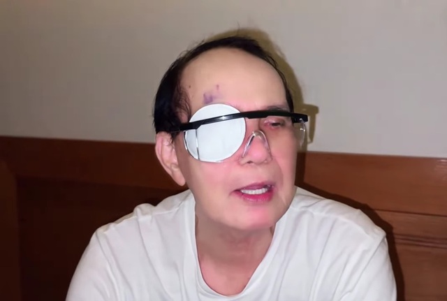 Nam NSND 81 tuổi phải phẫu thuật lần hai: "Hết rồi!"- Ảnh 1. Nam NSND 81 tuổi phải phẫu thuật lần hai: "Hết rồi!"- Ảnh 1.