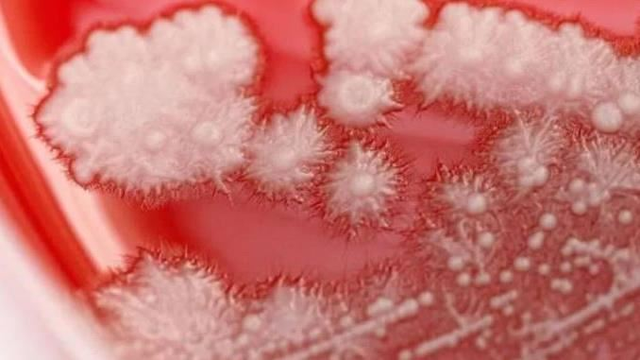 Người đ&agrave;n &ocirc;ng "họng trắng như tuyết" v&igrave; th&oacute;i quen n&agrave;y của nhiều người- Ảnh 1.