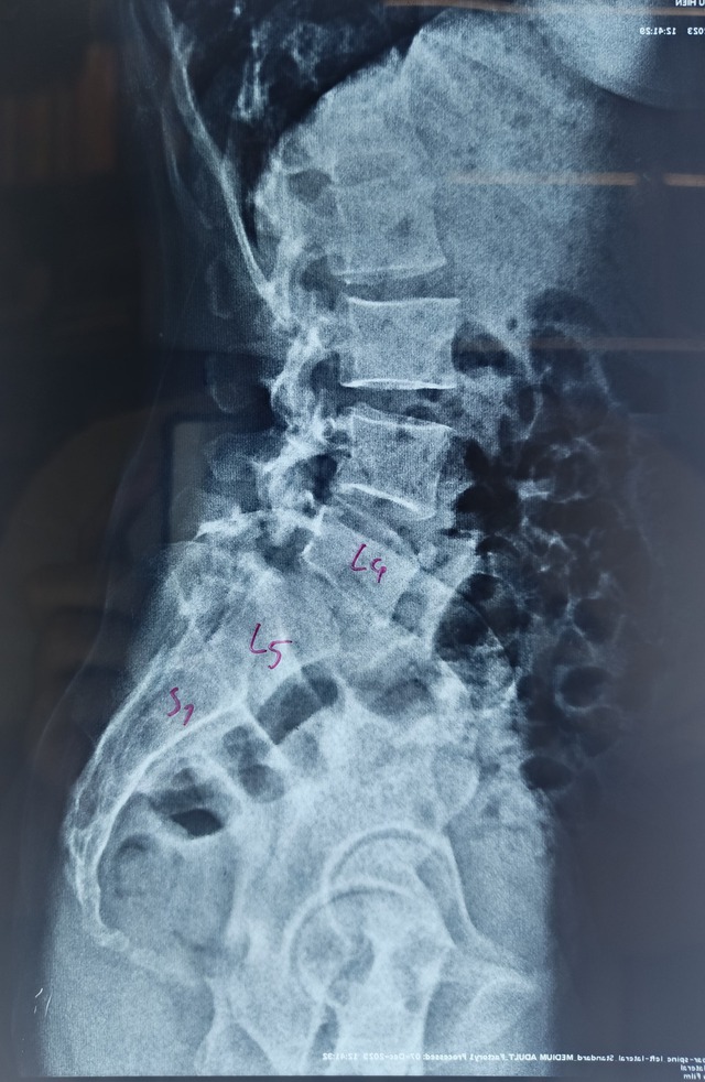 Yoga, pilates bị cấm với đối tượng này- Ảnh 3.