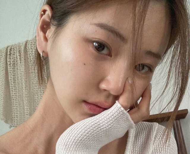 Vạch trần 4 tín hiệu ung thư thận qua làn da, bác sĩ: "Đừng chỉ biết kiểm tra nước tiểu"- Ảnh 3.