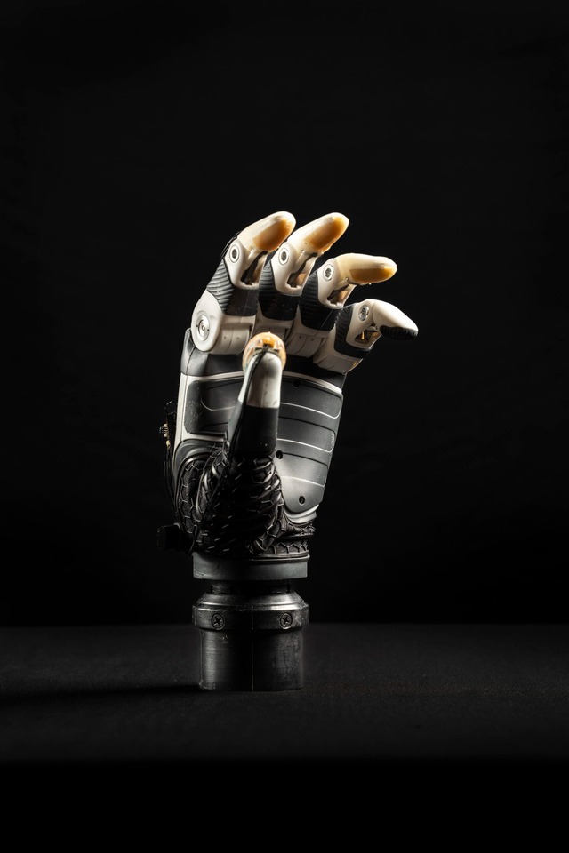 Kỹ sư Mỹ ph&aacute;t triển b&agrave;n tay sinh học t&iacute;ch hợp AI gi&uacute;p người khuyết tật cầm nắm ch&iacute;nh x&aacute;c như tay thật- Ảnh 2.