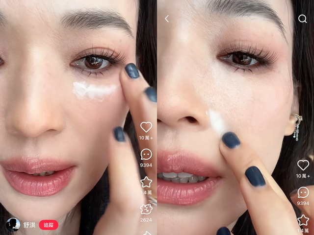 B&iacute; thuật x&oacute;a nếp nhăn v&agrave; r&atilde;nh cười của Thư Kỳ- Ảnh 2.