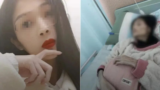 Nữ Tiktoker 27 tuổi qua đời v&igrave; chứng teo dạ d&agrave;y, l&uacute;c cuối đời chỉ c&ograve;n 17,5 kg: Mọi chuyện bắt đầu từ ho&agrave;n cảnh gia đ&igrave;nh- Ảnh 1.