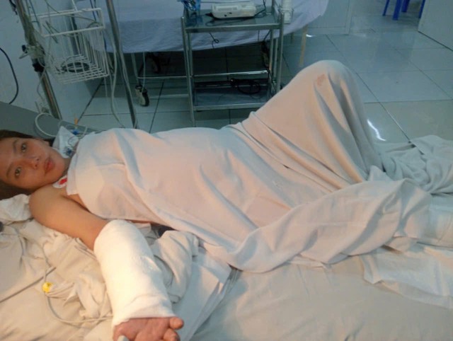 Kỳ Tích Y Học Việt Nam: Cấy Ghép Bàn Tay Đứt Lìa Lên Cẳng Chân Sản Phụ Mang Song Thai – Cuộc Chờ Đợi Nhân Văn Và Màn Tái Nối Chức Năng Vượt Qua Giới Hạn- Ảnh 2.