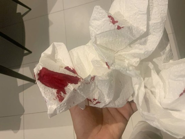 4 t&iacute;n hiệu sớm nhất cơ thể ph&aacute;t ra để &ldquo;cầu cứu&rdquo; v&igrave; ung thư cổ tử cung, tiếc l&agrave; &iacute;t chị em để &yacute;- Ảnh 1.