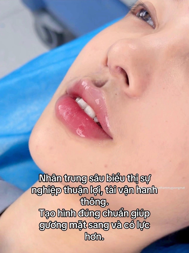 Nhân trung giọt nước chuẩn Trung Hoa khiến chị em phát sốt, người khen kẻ chê "chắc hứng nước luôn được"- Ảnh 2.