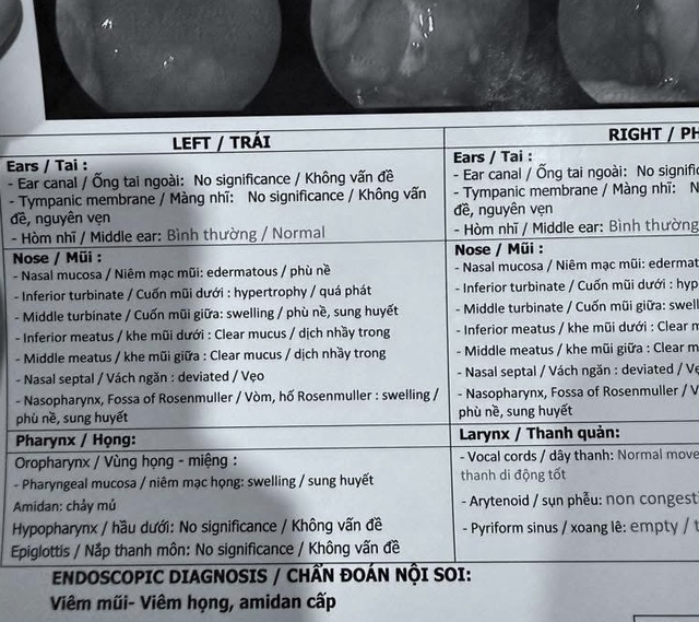 Chính xác thì Soobin đang bị gì?- Ảnh 2.
