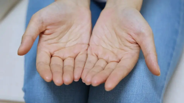 Nam giới mắc bệnh thận, thường xuyên ra mồ hôi ở 5 vị trí này- Ảnh 1. Nam giới mắc bệnh thận, thường xuyên ra mồ hôi ở 5 vị trí này- Ảnh 1.