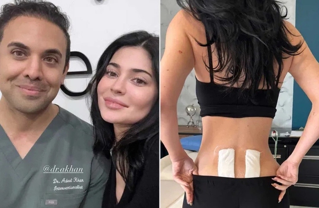 Kylie Jenner đang phải chữa bệnh gì?- Ảnh 2.