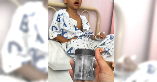 B&eacute; trai 12 tuổi mất 12 chiếc răng 1 l&uacute;c v&igrave; th&oacute;i quen nhiều trẻ mắc phải- Ảnh 1.