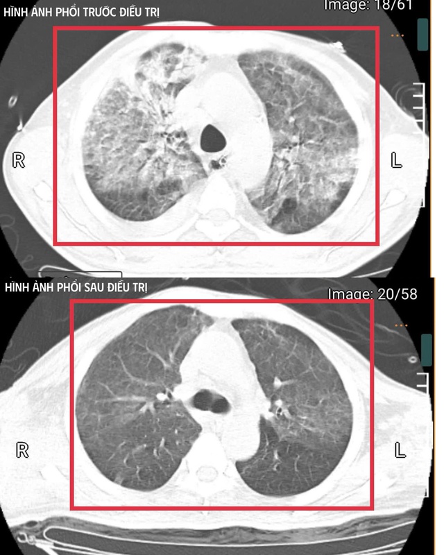 Người đ&agrave;n &ocirc;ng 35 tuổi mất phản xạ thở, nhiễm độc to&agrave;n th&acirc;n dữ dội: Thủ phạm khiến b&aacute;c sĩ cảnh b&aacute;o đỏ- Ảnh 1.