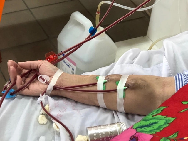 20 tuổi đ&atilde; phải chạy thận cả đời, b&aacute;c sĩ chỉ biết thốt l&ecirc;n đau x&oacute;t: "C&oacute; dấu hiệu suy thận thế n&agrave;y sao kh&ocirc;ng kh&aacute;m sớm"?- Ảnh 2.