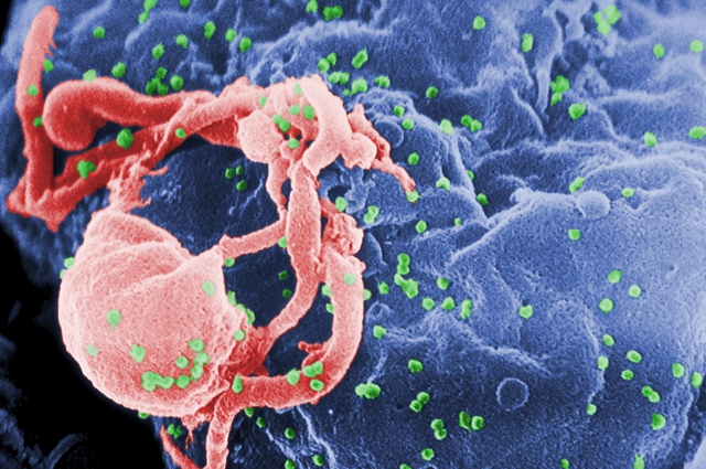 Hơn 40 năm trước, hai nhà khoa học người Pháp đã phát hiện ra loại virus làm thay đổi hoàn toàn lịch sử y học hiện đại- Ảnh 3. Hơn 40 năm trước, hai nhà khoa học người Pháp đã phát hiện ra loại virus làm thay đổi hoàn toàn lịch sử y học hiện đại- Ảnh 3.
