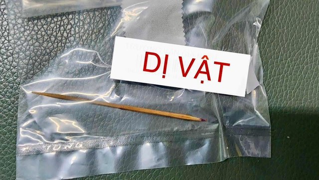 Bé trai 12 tuổi sốt kéo dài vì… nuốt phải tăm xỉa răng: Trường hợp hy hữu cảnh báo tai nạn nguy hiểm- Ảnh 1. Bé trai 12 tuổi sốt kéo dài vì… nuốt phải tăm xỉa răng: Trường hợp hy hữu cảnh báo tai nạn tải app hi88 hiểm- Ảnh 1.