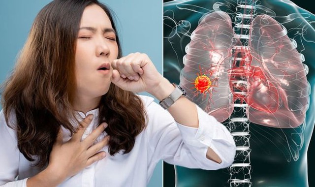 Ngày nào cũng tỉnh dậy vào khung giờ này chứng tỏ phổi đã bị tổn thương, nếu có thêm 6 dấu hiệu thì phải đi khám ngay- Ảnh 3.
