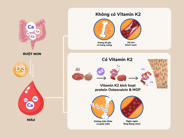 Chuyên gia chỉ ra vai trò then chốt của vitamin K2 trong chuyển hóa canxi- Ảnh 1. Chuyên gia chỉ ra vai trò then chốt của vitamin K2 trong chuyển hóa canxi- Ảnh 1.