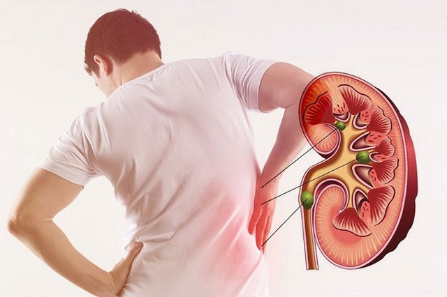 Người đàn ông suy thận mạn giai đoạn cuối, vừa trải qua ghép thận, phải uống thuốc chống thải ghép suốt đời: ‘Đừng chỉ chăm hi88.com là gì ước mơ, mà quên chăm hi88.com là gì quả thận, lá gan…’ - Ảnh 2.