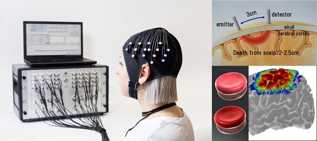 Lần đầu tiên, các nhà khoa học bắn được tia laser xuyên qua đầu một người đàn ông, và ông ấy vẫn còn sống- Ảnh 5. Lần đầu tiên, các nhà khoa học bắn được tia laser xuyên qua đầu một người đàn ông, và ông ấy vẫn còn sống- Ảnh 5.