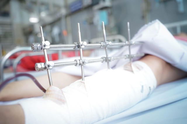 Khẩn trương mổ xuyên đêm cứu bệnh nhân bị đa chấn thương trong vụ sập nhà do mưa lớn, gây tử vong 2 bà cháu- Ảnh 2. Khẩn trương mổ xuyên đêm cứu bệnh nhân bị đa chấn thương trong vụ sập nhà do mưa lớn, gây tử vong 2 bà cháu- Ảnh 2.