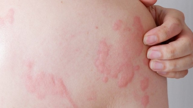 Bác sĩ chỉ ra sai lầm “chết người” về một căn bệnh mà nhiều người vẫn vô tư điều trị tại nhà- Ảnh 1. Bác sĩ chỉ hi88.com lừa đảo lầm “chết người” về một căn bệnh mà nhiều người vẫn vô tư điều trị tại nhà- Ảnh 1.