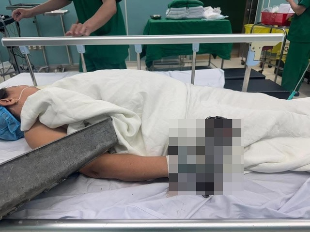 Cảnh báo tai nạn lao động nguy hiểm từ máy xay thịt- Ảnh 2. Cảnh báo tai nạn lao động nguy hiểm từ máy xay thịt- Ảnh 2.