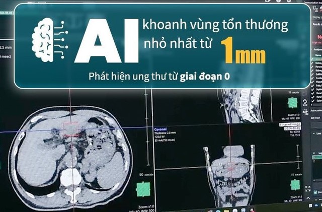 Người Nhật “thảnh thơi” với ung thư, vì sao vậy?- Ảnh 4. Người Nhật “thảnh thơi” với ung thư, vì sao vậy?- Ảnh 4.
