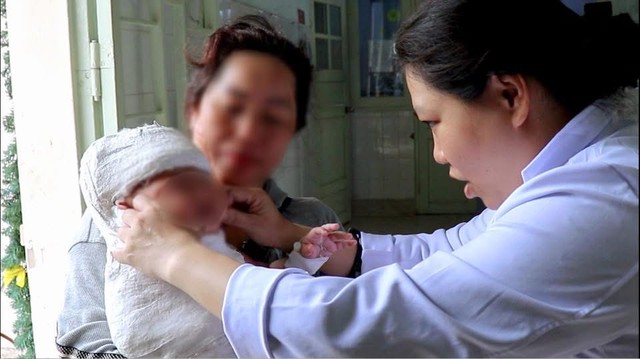 Phẫu thuật thành công cho bé 5 tháng tuổi bị liệt đám rối thần kinh cánh tay do sang chấn sản khoa- Ảnh 2. Phẫu thuật thành công cho bé 5 tháng tuổi bị liệt đám rối thần kinh cánh tay do sang chấn sản khoa- Ảnh 2.