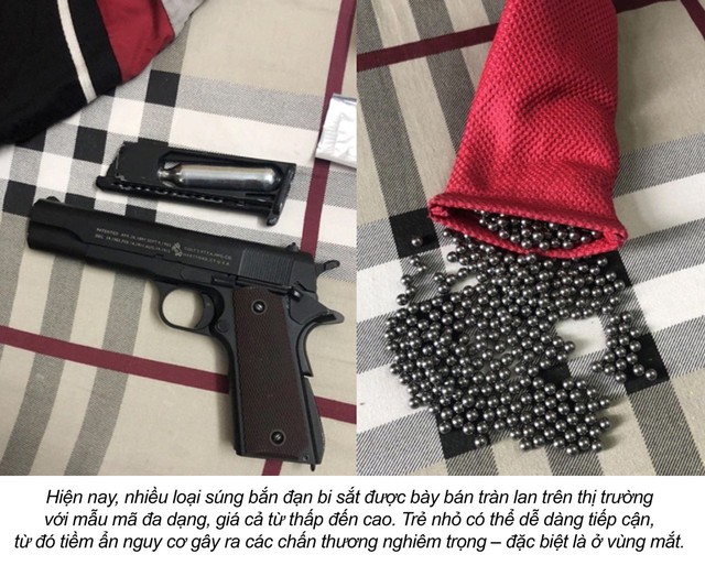 Hi hữu: Gắp viên bi sắt 6mm nằm trong mí mắt nam sinh 15 tuổi suốt nhiều ngày- Ảnh 2.