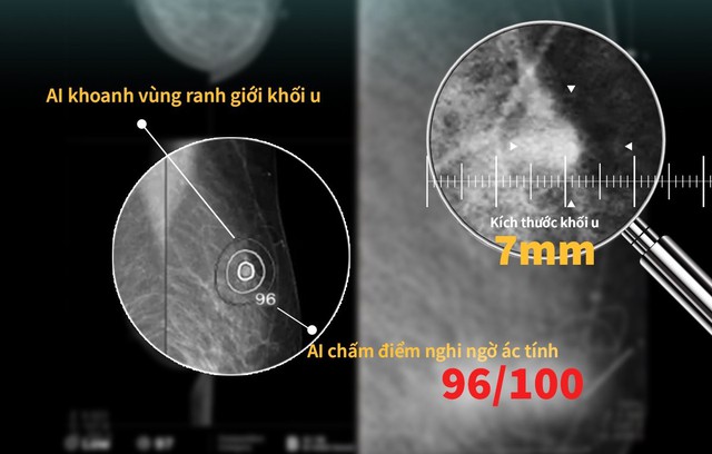 3 thứ trên cơ thể mà tế bào ung thư “ĐẶC BIỆT YÊU THÍCH”, khám định kỳ vẫn dễ để lọt khối u- Ảnh 3. 3 thứ trên cơ thể mà tế bào ung thư “ĐẶC BIỆT YÊU THÍCH”, khám định kỳ vẫn dễ để lọt khối u- Ảnh 3.