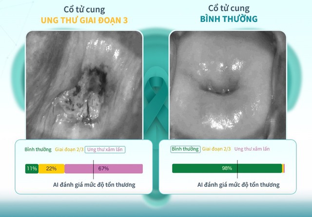 3 thứ trên cơ thể mà tế bào ung thư “ĐẶC BIỆT YÊU THÍCH”, khám định kỳ vẫn dễ để lọt khối u- Ảnh 6. 3 thứ trên cơ thể mà tế bào ung thư “ĐẶC BIỆT YÊU THÍCH”, khám định kỳ vẫn dễ để lọt khối u- Ảnh 6.