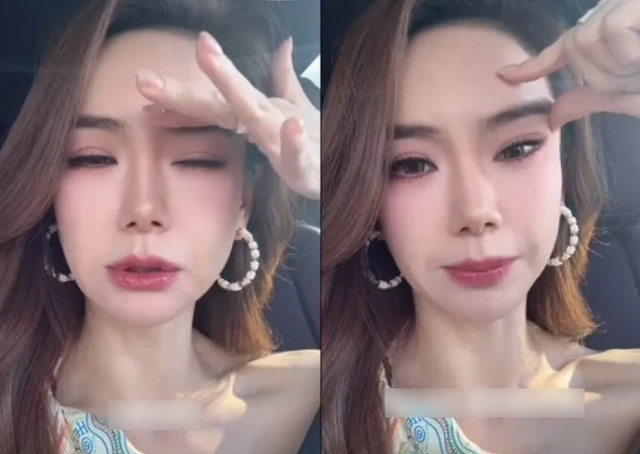Nữ diễn viên nổi tiếng thừa nhận gương mặt "cứng đờ" vì tiêm botox quá liều, bác sĩ cảnh báo: 0,00000005 gram chất này có thể gây tử vong- Ảnh 1. Nữ diễn viên nổi tiếng thừa nhận gương mặt "cứng đờ" vì tiêm botox quá liều, bác sĩ cảnh báo: 0,00000005 gram chất này có thể gây tử vong- Ảnh 1.