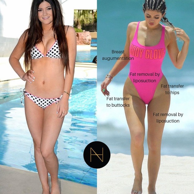 Nhà Kardashian - Jenner bị bóc mẽ nhan sắc giả dối: Từ mẹ đến con đều "cà ảnh" đến dị dạng bộ phận này- Ảnh 7. Nhà Kardashian - Jenner bị bóc mẽ nhan sắc giả dối: Từ mẹ đến con đều "cà ảnh" đến dị dạng bộ phận này- Ảnh 7.