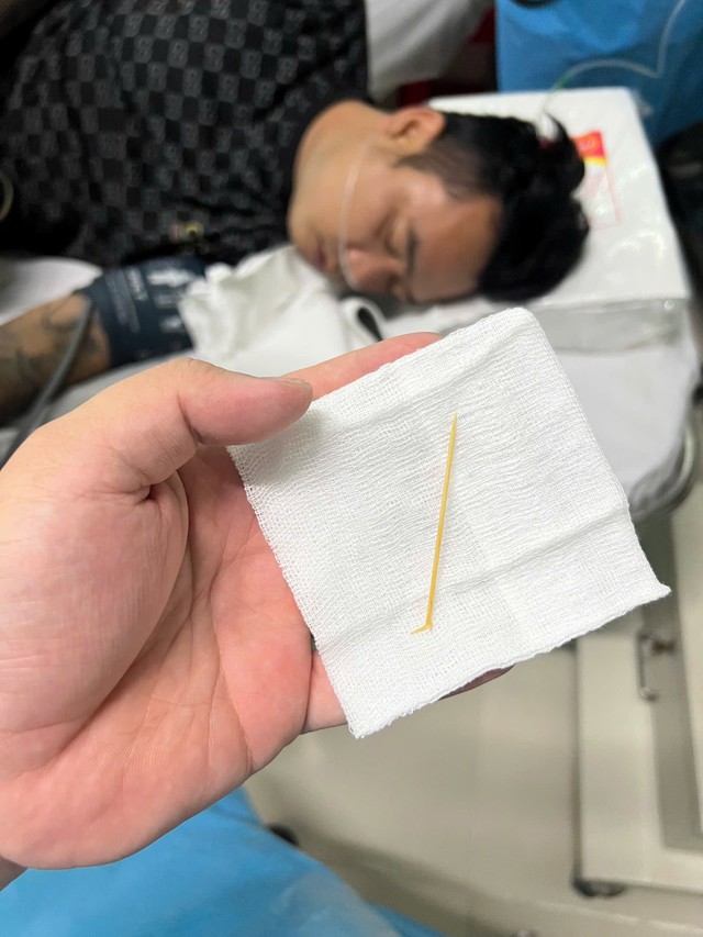 Xử lý thành công ca: Gắp dị vật tăm tre xuyên thủng dạ dày bằng nội soi cấp cứu- Ảnh 2. Xử lý thành công ca: Gắp dị vật tăm tre xuyên thủng dạ dày bằng nội soi cấp cứu- Ảnh 2.