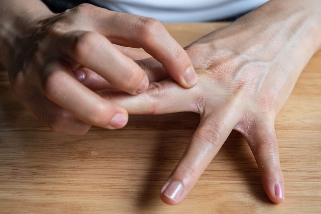 2 bộ phận tr&ecirc;n cơ thể hay ngứa ng&aacute;y c&oacute; thể l&agrave; dấu hiệu ung thư gan, nhiều người dễ lầm tưởng l&agrave; dị ứng- Ảnh 1.