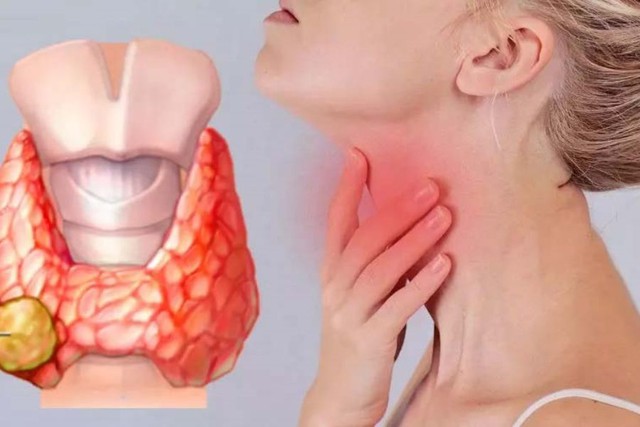 Cứ tưởng tăng cân, rụng tóc là do trầm cảm sau sinh, người phụ nữ 29 tuổi không ngờ phải đối mặt với căn bệnh nguy hiểm hơn thế- Ảnh 3.