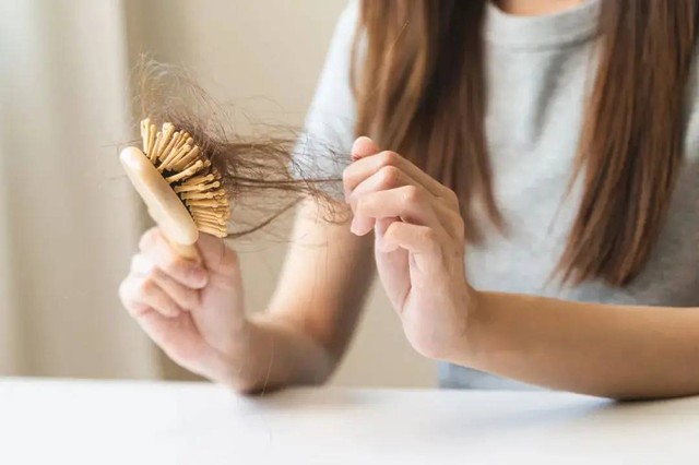 Tóc rụng lả tả chưa chắc là do thiếu chất, 4 thói quen vô tình này khiến tóc của bạn rụng nhiều hơn, điều thứ 3 lắm người mắc nhất- Ảnh 1. Tóc rụng lả tả chưa chắc là do thiếu chất, 4 thói quen vô tình này khiến tóc của bạn rụng nhiều hơn, điều thứ 3 lắm người mắc nhất- Ảnh 1.