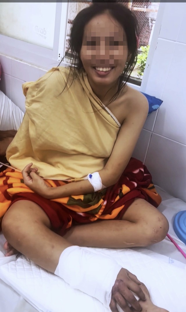 Để mẹ trọn vẹn vòng tay ôm con: bác sĩ ghép tạm bàn tay đứt lìa vào chân thai phụ- Ảnh 2.