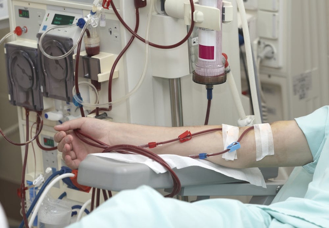 Cô gái 22 tuổi suy thận, ngừng lich bong da truc tiep uống thứ này liên tục 4 năm: Bác sĩ nói "nên bỏ ngay"- Ảnh 1.