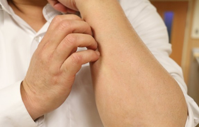 Suy thận giai đoạn cuối được ph&aacute;t hiện sau khi cơ thể c&oacute; 1 triệu chứng v&ocirc; hại, người đ&agrave;n &ocirc;ng l&ecirc;n tiếng cảnh b&aacute;o- Ảnh 1.