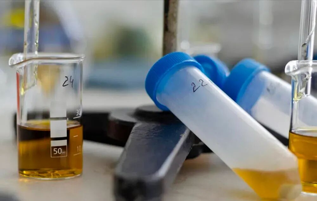 Thận su&yacute;t &ldquo;hỏng ho&agrave;n to&agrave;n&rdquo;, người đ&agrave;n &ocirc;ng 42 tuổi thầm cảm ơn bản th&acirc;n v&igrave; ch&uacute; &yacute; 1 dấu hiệu nhiều người bỏ qua- Ảnh 3.